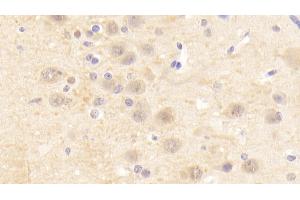 Detection of CHRNa4 in Human Cerebrum Tissue using Polyclonal Antibody to Cholinergic Receptor, Nicotinic, Alpha 4 (CHRNa4)