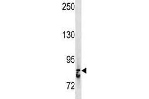 Western Blotting (WB) image for anti-Signal Transducer and Activator of Transcription 3 (Acute-Phase Response Factor) (STAT3) (AA 673-699) antibody (ABIN3032571)