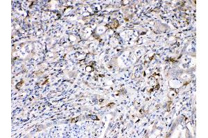 IHC analysis of Bax using anti-Bax antibody . (BAX 抗体  (N-Term))