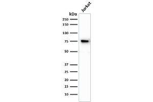 Western Blotting (WB) image for anti-Moesin (MSN) antibody (ABIN6940085)