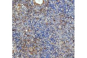 IHC analysis of ICAM1 using anti-ICAM1 antibody (ABIN5692991). (ICAM1 抗体  (AA 28-268))