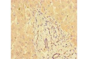Immunohistochemistry of paraffin-embedded human liver tissue using ABIN7165948 at dilution of 1:100 (PPM1H 抗体  (AA 73-289))