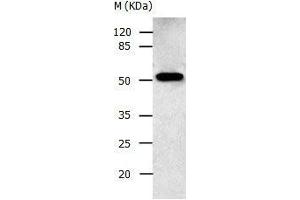 Gel: 10 % SDS-PAGE Lysate: 30 μg Human fetal brain tissue lysate Primary antibody: 1/500 dilution Secondary antibody: Donkey anti Rabbit IgG - H&L (HRP) at 1/3000 dilution Exposure time: 30 seconds (AAK1 抗体  (N-Term))