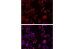 Immunofluorescence analysis of SW480 cells showing nuclear and cytoplasmic localization with NOTCH3 antibody 1:200 (top,red). (NOTCH3 抗体)