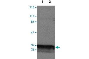 Western blot analysis of YWHAQ expression in HeLa (Lane 1) and Jurkat (Lane 2) whole cell lysates.