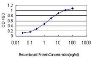 Detection limit for recombinant GST tagged IRAK2 is approximately 0. (IRAK2 抗体  (AA 111-210))