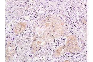 Immunohistochemistry (IHC) image for anti-Cyclin-Dependent Kinase Inhibitor 1A (p21, Cip1) (CDKN1A) (pThr57) antibody (ABIN756877)