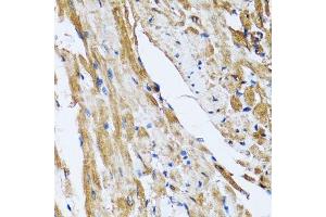 Immunohistochemistry of paraffin-embedded rat heart using GOLM1 antibody. (GOLM1 抗体  (AA 112-401))