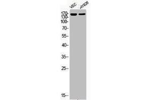 Western Blot analysis of VEC HY929 cells using Phospho-HDAC5 (S498) Polyclonal Antibody (HDAC5 抗体  (pSer498))