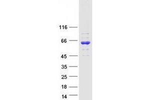 Western Blotting (WB) image for Growth Factor Receptor-Bound Protein 7 (GRB7) (Transcript Variant 2) protein (Myc-DYKDDDDK Tag) (ABIN2722231)