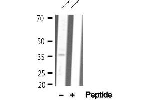 Western blot analysis of extracts of HL-60 cells, using MDH1 antibody. (MDH1 抗体  (C-Term))