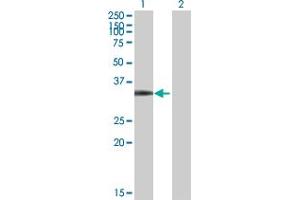 Western Blotting (WB) image for anti-Cyclin-Dependent Kinase 4 (CDK4) (AA 1-303) antibody (ABIN514273)