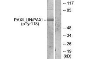 Western blot analysis of extracts from HeLa cells treated with EGF, using Paxillin (Phospho-Tyr118) Antibody. (Paxillin 抗体  (pTyr118))