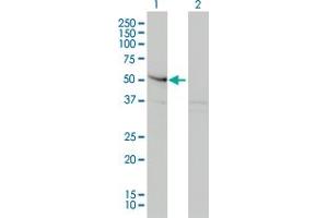 Western Blot analysis of SMAD3 expression in transfected 293T cell line by SMAD3 monoclonal antibody (M01), clone 2C12. (SMAD3 抗体  (AA 120-221))