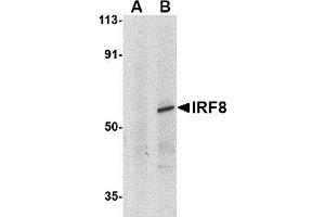 Western blot analysis of IRF8 in human thymus tissue lysate with AP30451PU-N IRF8 antibody at 1μg/ml in (A) the presence and (B) absence of blocking peptide. (IRF8 抗体)