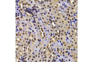 Immunohistochemistry of paraffin-embedded mouse kidney using WHSC1 antibody at dilution of 1:100 (40x lens). (WHSC1 抗体)