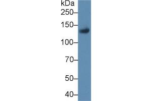 Western blot analysis of Rat Placenta lysate, using Rat LIFR Antibody (1 µg/ml) and HRP-conjugated Goat Anti-Rabbit antibody ( (LIFR 抗体  (AA 642-791))