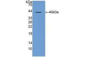 Detection of Recombinant MIP1a, Rat using Polyclonal Antibody to Macrophage Inflammatory Protein 1 Alpha (MIP1a) (CCL3 抗体  (AA 24-92))
