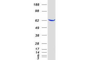Validation with Western Blot