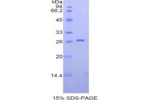 SDS-PAGE analysis of Human SIGLEC2 Protein. (CD22 蛋白)