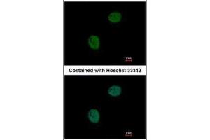ICC/IF Image Immunofluorescence analysis of paraformaldehyde-fixed HeLa, using GNAT2, antibody at 1:500 dilution. (GNAT2 抗体  (Center))