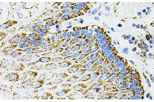 Immunohistochemistry of paraffin-embedded Human esophagus using EPO Polyclonal Antibody (EPO 抗体)