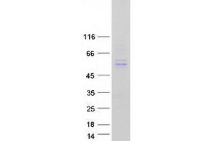 Western Blotting (WB) image for Tubulointerstitial Nephritis Antigen-Like 1 (TINAGL1) protein (Myc-DYKDDDDK Tag) (ABIN2733771)