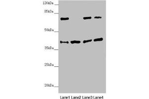 Western blot All lanes: DSN1 antibody at 2. (DSN1 抗体  (AA 1-356))