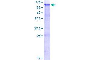 Melanoma gp100 Protein (AA 1-661) (GST tag)