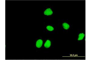 Immunofluorescence of monoclonal antibody to ZNF323 on HeLa cell. (Zinc Finger and SCAN Domain Containing 31 (ZSCAN31) (AA 1-209) 抗体)