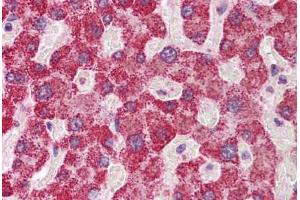 Human Liver: Formalin-Fixed, Paraffin-Embedded (FFPE) (SH2B1 抗体  (AA 395-444))