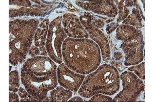 Image no. 5 for anti-Rhotekin (RTKN) antibody (ABIN1500702)