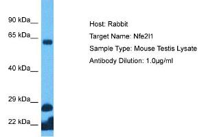 Host: Rabbit Target Name: NFE2L1 Sample Tissue: Mouse Testis Antibody Dilution: 1ug/ml