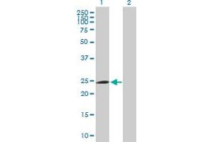 Western Blot analysis of FBXO42 expression in transfected 293T cell line by FBXO42 MaxPab polyclonal antibody.