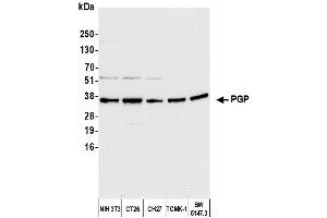 Western Blotting (WB) image for anti-Phosphoglycolate Phosphatase (PGP) (AA 271-321) antibody (ABIN7451551) (PGP 抗体  (AA 271-321))