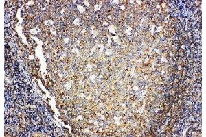 Anti-IL4 antibody, IHC(P) IHC(P): Human Tonsil Tissue (IL-4 抗体  (Middle Region))