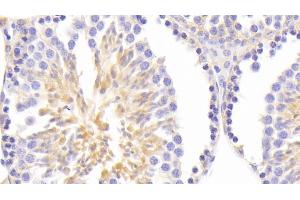 Detection of ASNS in Mouse Testis Tissue using Polyclonal Antibody to Asparagine Synthetase (ASNS) (Asparagine Synthetase 抗体  (AA 213-561))