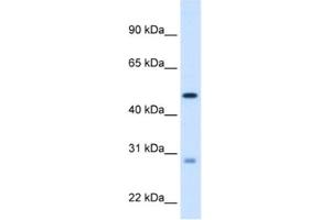 Western Blotting (WB) image for anti-Enoyl CoA Hydratase, Short Chain, 1, Mitochondrial (ECHS1) antibody (ABIN2462886) (ECHS1 抗体)