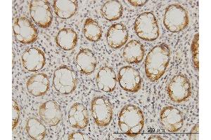 Immunoperoxidase of monoclonal antibody to LASS6 on formalin-fixed paraffin-embedded human colon. (CERS6 抗体  (AA 62-131))