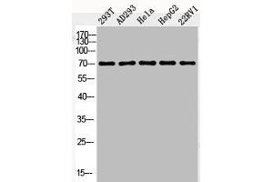 Western Blot analysis of 293T AD293 HELA HepG2 22RV1 cells using Phospho-c-Fos (S362) Polyclonal Antibody (c-FOS 抗体  (pSer362))