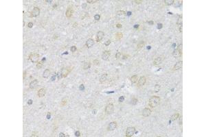 Immunohistochemistry of paraffin-embedded Rat brain using P2RX7 Polyclonal Antibody at dilution of 1:100 (40x lens). (P2RX7 抗体)