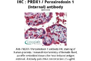 Image no. 1 for anti-Peroxiredoxin 1 (PRDX1) (Internal Region) antibody (ABIN1738319) (Peroxiredoxin 1 抗体  (Internal Region))