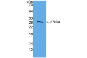 Western blot analysis of recombinant Human ELA3B. (Elastase 3B 抗体  (AA 29-270))