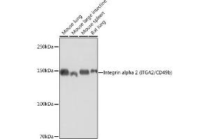 Western blot analysis of extracts of various cell lines, using Integrin alpha 2 (ITG/CD49b) (ITG/CD49b) antibody  at 1:1000 dilution. (ITGA2 抗体)