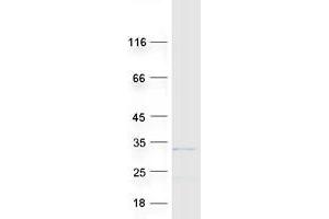 Western Blotting (WB) image for Rhophilin Associated Tail Protein 1-Like (ROPN1L) protein (Myc-DYKDDDDK Tag) (ABIN2731068)