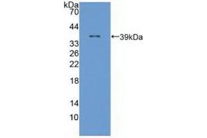 Detection of Recombinant ALOX12, Human using Polyclonal Antibody to Arachidonate-12-Lipoxygenase (ALOX12) (ALOX12 抗体  (AA 352-656))