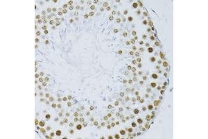 Immunohistochemistry of paraffin-embedded rat testis using SNRNP70 antibody. (SNRNP70 抗体  (AA 150-250))