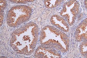 Immunohistochemistry of paraffin-embedded human kidney tissue using ABIN7158090 at dilution of 1:100 (LRRN3 抗体  (AA 201-500))