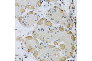 Immunohistochemistry of paraffin-embedded human stomach using ANAPC10 antibody at dilution of 1:100 (x40 lens). (ANAPC10 抗体)