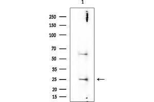 anti-Fast Skeletal Troponin I (TNNI2) antibody